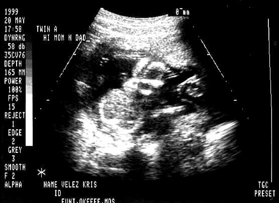 babies-4.JPG - 21.3 K