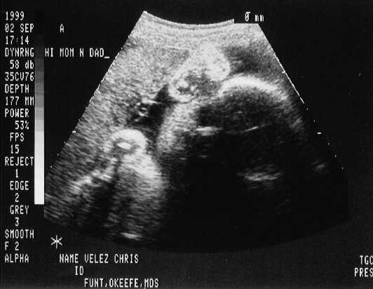 sono-0902-a1.JPG - 22.3 K