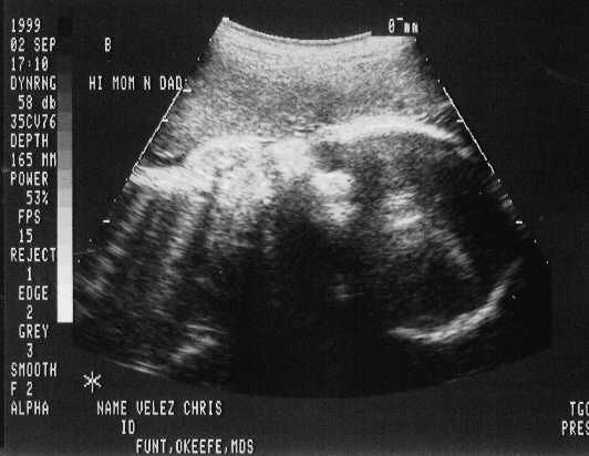 sono-0902-b1.JPG - 22.9 K