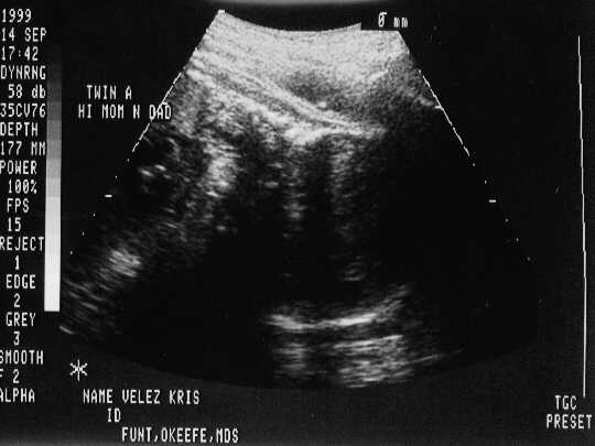 sono-0914-a.JPG - 20.5 K