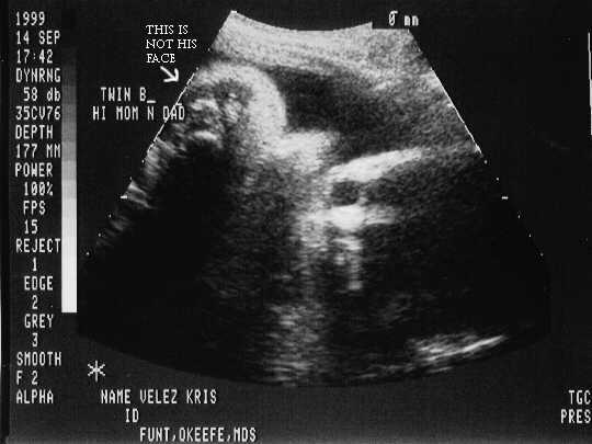 sono-0914-b-1.JPG - 22.4 K